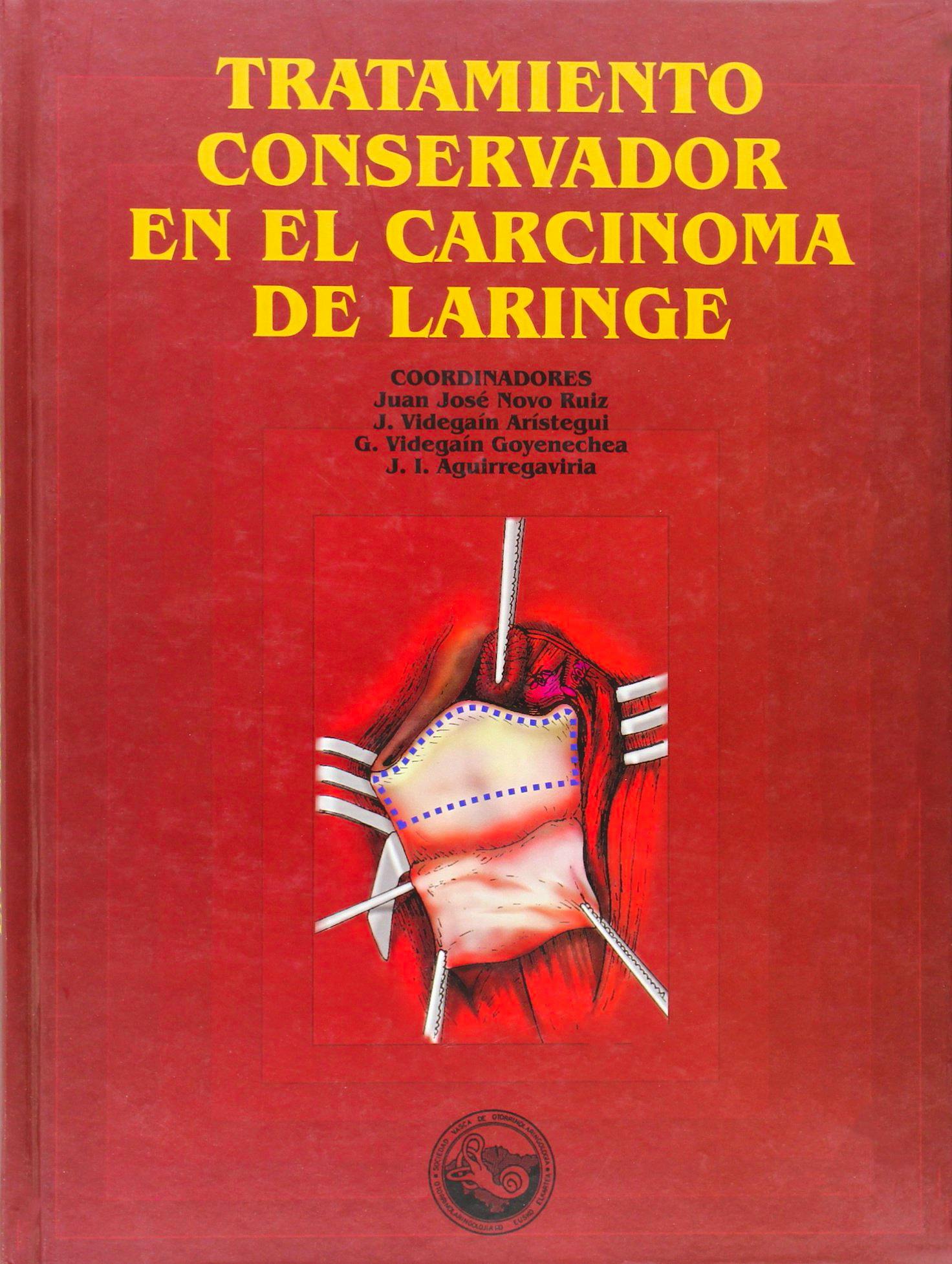 Portada del libro 9788483733882 Tratamiento Conservador en el Carcinoma de Laringe