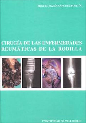 Portada del libro 9788484481928 Cirugia de las Enfermedades Reumaticas de la Rodilla