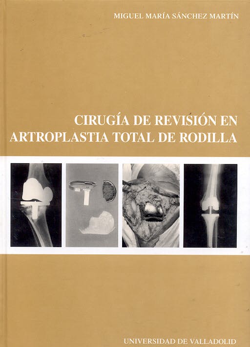 Portada del libro 9788484483618 Cirugia de Revision en Artroplastia Total de Rodilla
