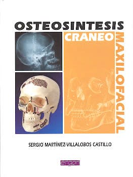 Portada del libro 9788484730804 Osteosintesis Craneo-Maxilofacial