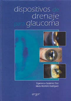 Portada del libro 9788484731030 Dispositivos de Drenaje para Glaucoma