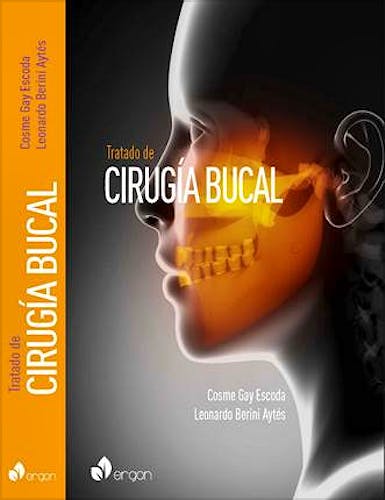 Portada del libro 9788484731924 Tratado de Cirugía Bucal