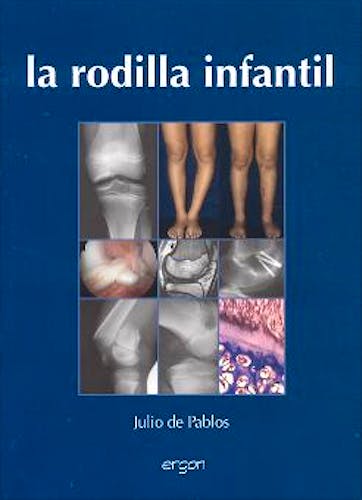 Portada del libro 9788484732082 La Rodilla Infantil