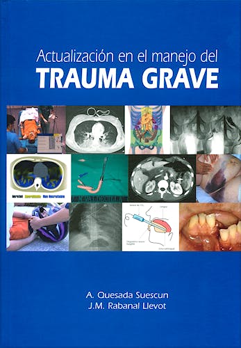 Portada del libro 9788484734840 Actualización en el Manejo del Trauma Grave