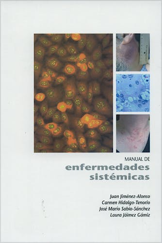 Portada del libro 9788484735465 Manual de Enfermedades Sistemicas