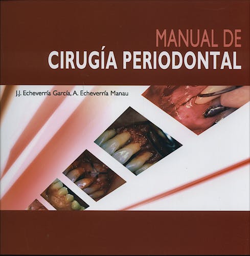 Portada del libro 9788484736486 Manual de Cirugía Periodontal