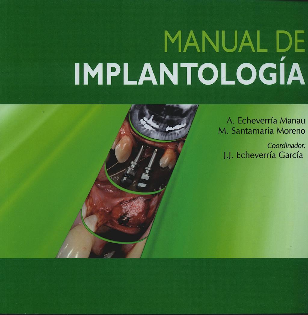 Portada del libro 9788484738183 Manual de Implantologia