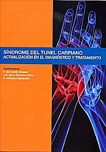 Portada del libro 9788484739296 Sindrome del Tunel Carpiano. Actualizacion en el Diagnostico y Tratamiento
