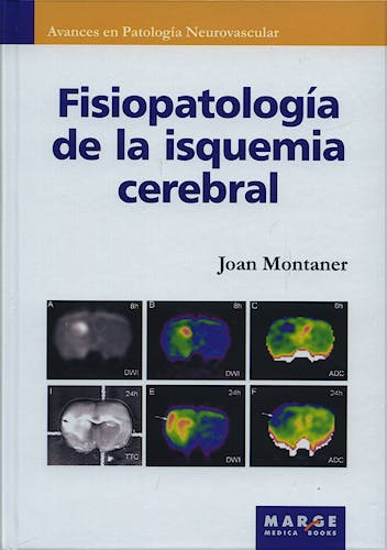 Portada del libro 9788486684839 Fisiopatologia de la Isquemia Cerebral