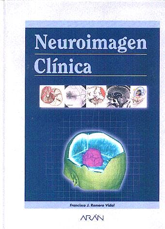 Portada del libro 9788486725556 Neuroimagen Clínica