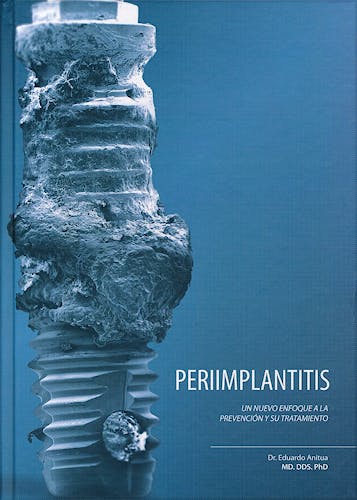 Portada del libro 9788487673290 Periimplantitis. Un Nuevo Enfoque a la Prevención y Su Tratamiento
