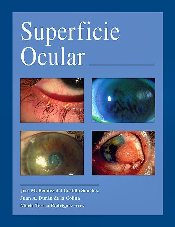 Portada del libro 9788489085251 Superficie Ocular