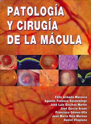 Portada del libro 9788489085442 Patologia y Cirugia de la Macula