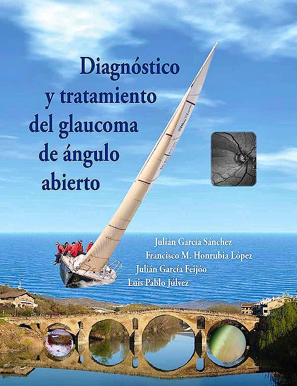 Portada del libro 9788489085534 Diagnóstico y Tratamiento del Glaucoma de Ángulo Abierto