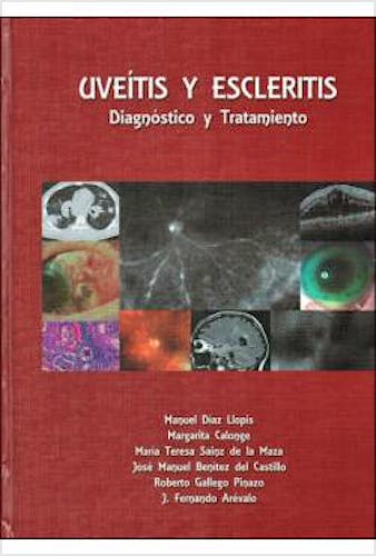 Portada del libro 9788489085565 Uveitis y Escleritis. Diagnóstico y Tratamiento