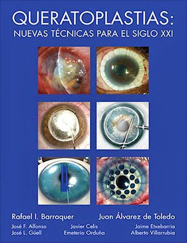Portada del libro 9788489085626 Queratoplastias: Nuevas Técnicas para el Siglo XXI