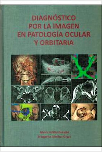 Portada del libro 9788489085657 Diagnóstico por la Imagen en Patología Ocular y Orbitaria
