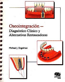 Portada del libro 9788489873001 Oseointegracion - Diagnostico Clinico y Alternativas Restauradoras