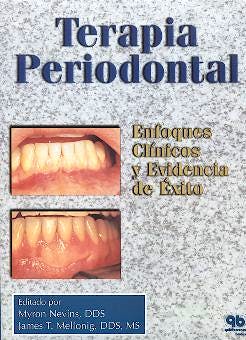 Portada del libro 9788489873216 Terapia Periodontal: Enfoques Clinicos y Evidencia de Éxito