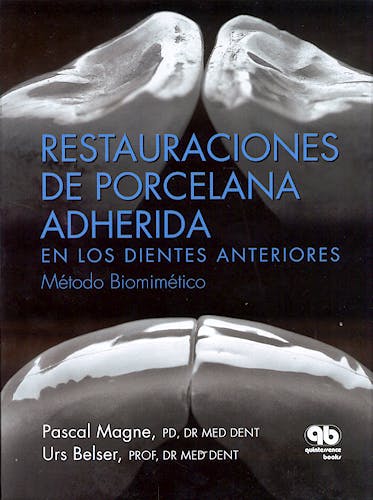 Portada del libro 9788489873285 Restauraciones de Porcelana Adherida en los Dientes Anteriores. Método Biomimético