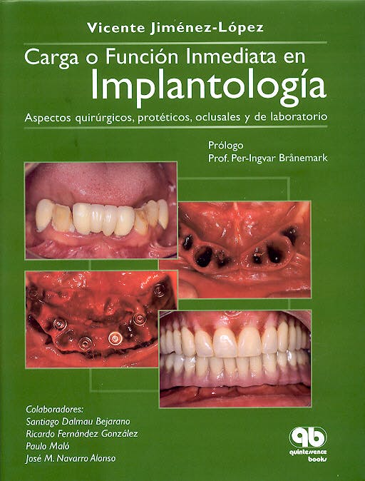 Portada del libro 9788489873308 Carga o Funcion Inmediata en Implantologia. Aspectos Quirurgicos, Protesicos, Oclusales y de Laboratorio.
