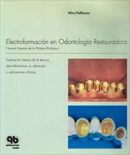 Portada del libro 9788489873315 Electroformación en Odontología Restauradora. Nuevas Facetas