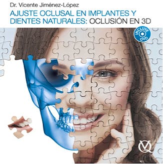 Portada del libro 9788489873582 Ajuste Oclusal en Implantes y Dientes Naturales. Oclusión en 3D + DVD
