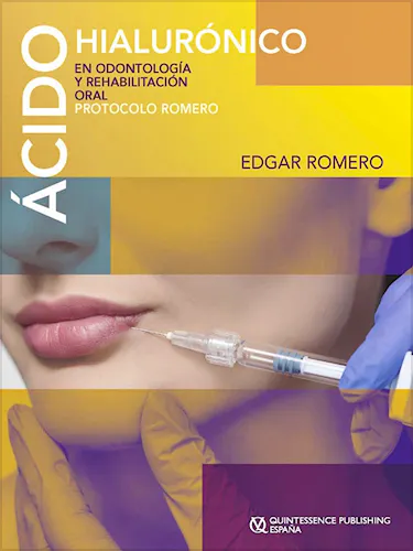 Portada del libro 9788489873957 Ácido Hialurónico en Odontología y Rehabilitación Oral. Protocolo Romero