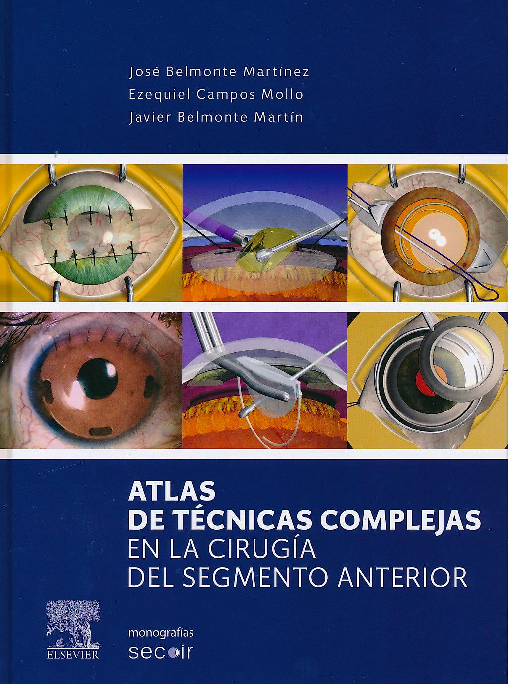 Portada del libro 9788490223024 Atlas de Tecnicas Complejas en la Cirugia del Segmento Anterior (Monografias Secoir)