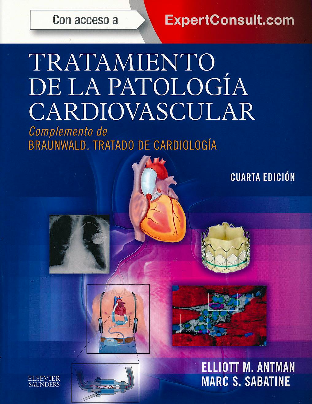Portada del libro 9788490224397 Tratamiento de la Patologia Cardiovascular. Complemento de Braunwald Tratado de Cardiologia + Acceso Online al Libro en Ingles