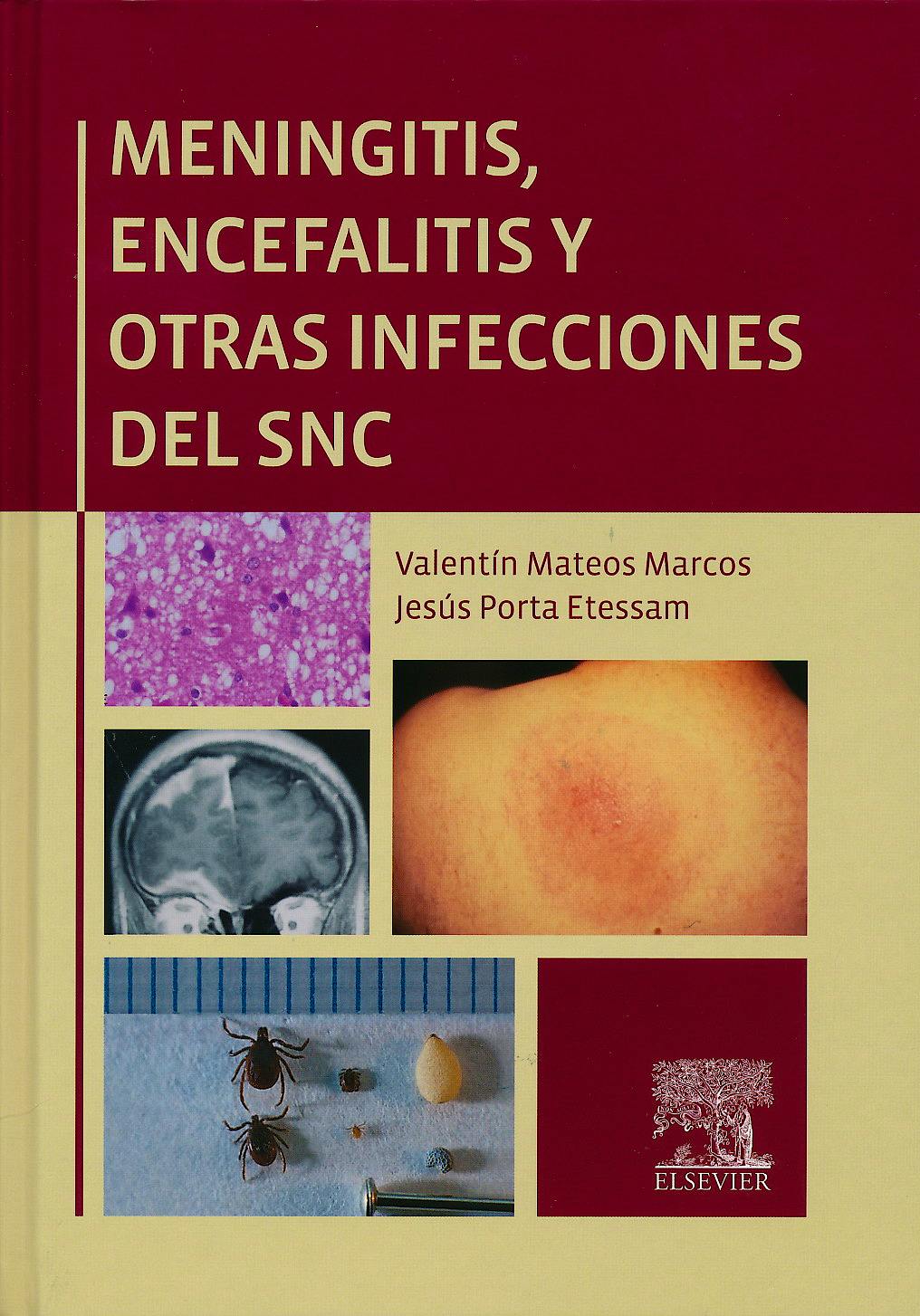 Portada del libro 9788490224847 Meningitis, Encefalitis y Otras Infecciones del Snc