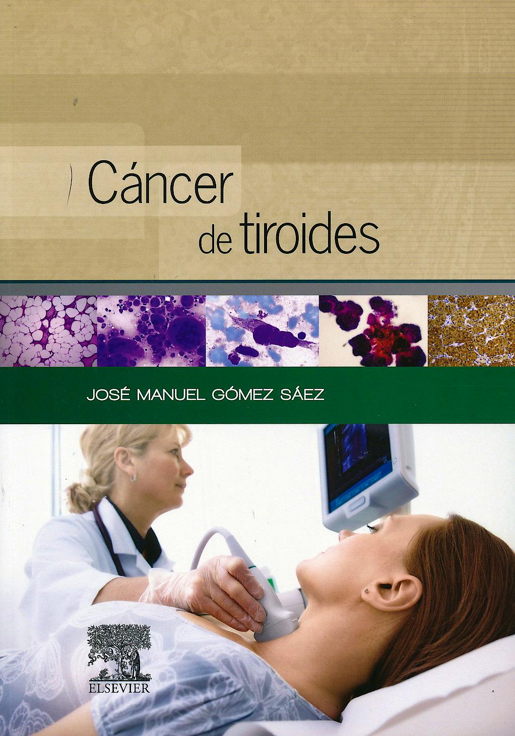 Portada del libro 9788490225028 Cáncer de Tiroides