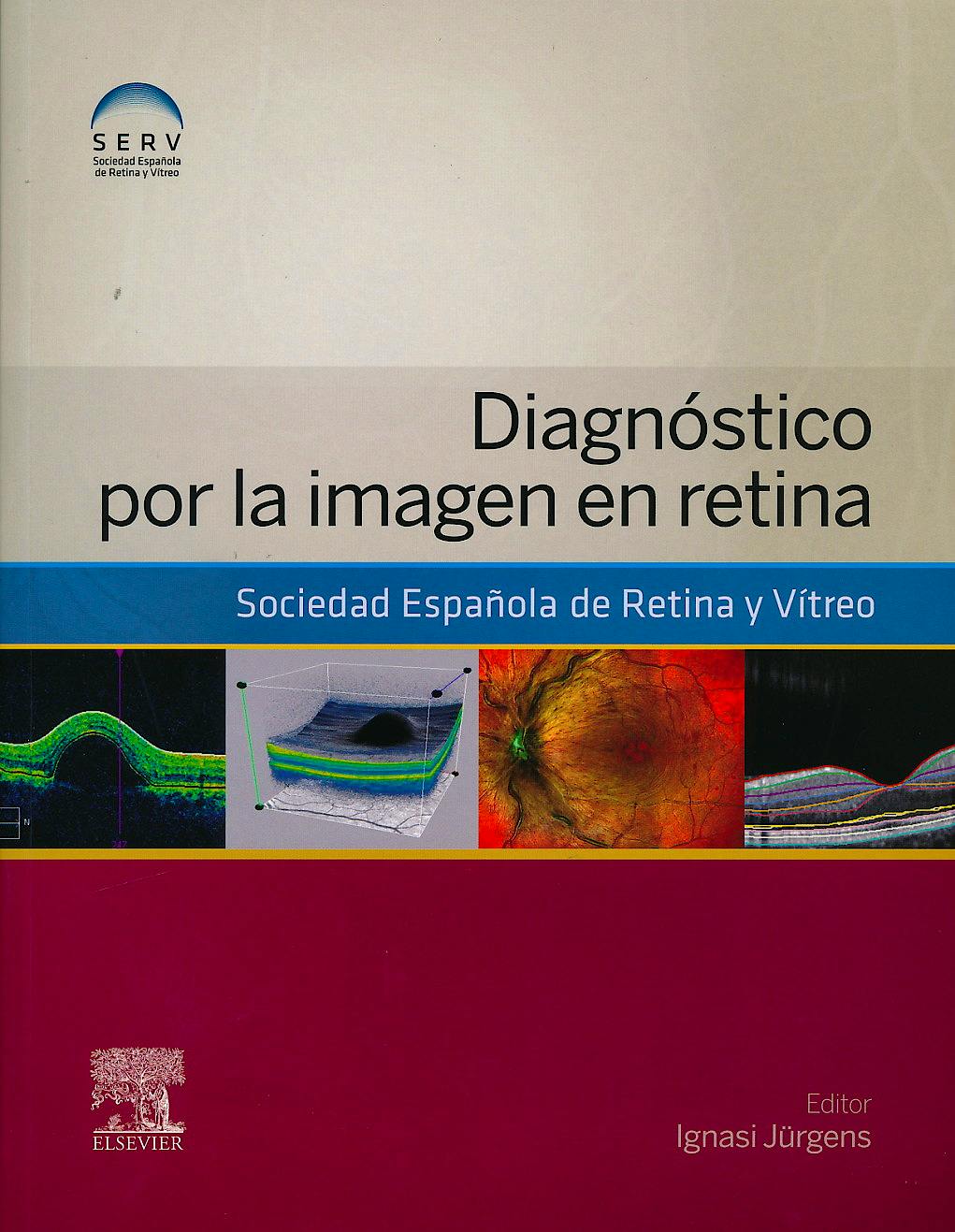 Portada del libro 9788490227213 Diagnostico por la Imagen en Retina