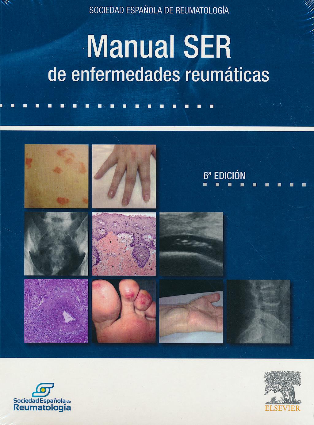 Portada del libro 9788490229033 Manual SER de Enfermedades Reumáticas