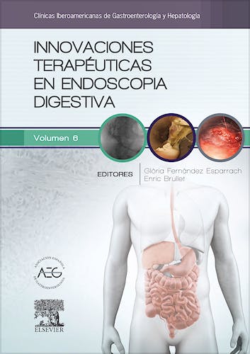 Portada del libro 9788490229538 Innovaciones Terapéuticas en Endoscopia Digestiva (Clínicas Iberoamericanas de Gastroenterología y Hepatología, Vol. 6)