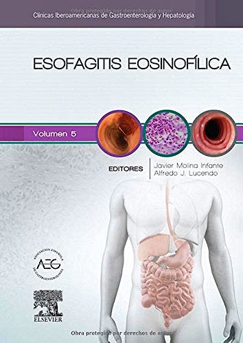 Portada del libro 9788490229545 Esofagitis Eosinofílica (Clínicas Iberoamericanas de Gastroenterología y Hepatología, Vol. 5)