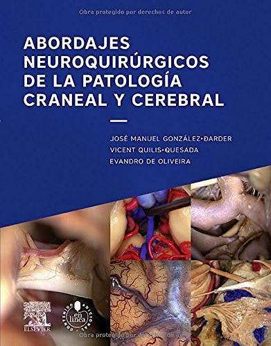Portada del libro 9788490229552 Abordajes Neuroquirúrgicos de la Patología Craneal y Cerebral
