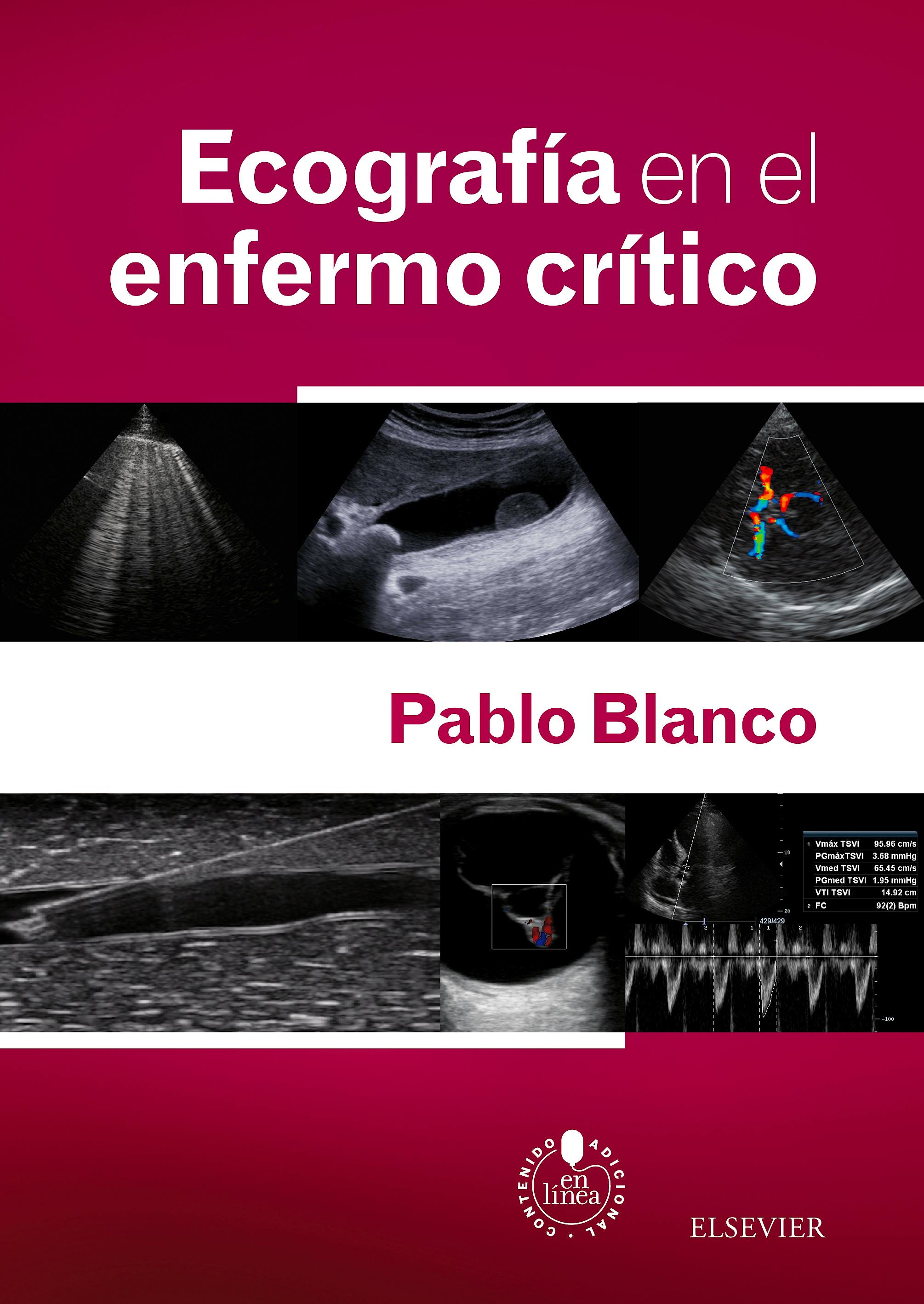 Portada del libro 9788490229842 Ecografía en el Enfermo Crítico + Acceso Online
