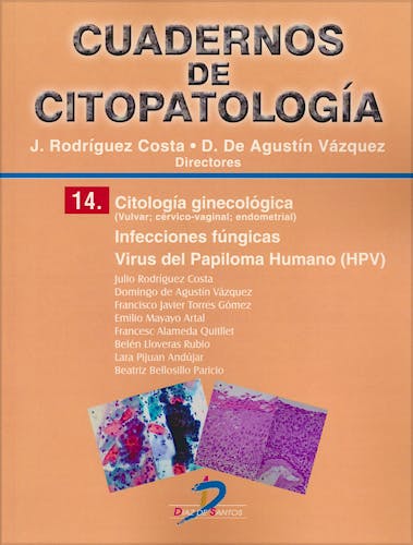 Portada del libro 9788490520437 Cuadernos de Citopatología 14: Citología Ginecológica, Infecciones Fúngicas, Virus del Papiloma Humano (HPV)