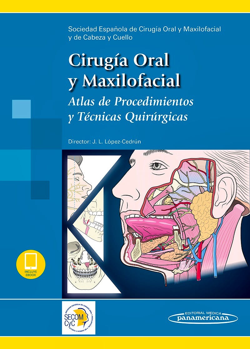 Portada del libro 9788491101123 Cirugía Oral y Maxilofacial. Atlas de Procedimientos y Técnicas Quirúrgicas
