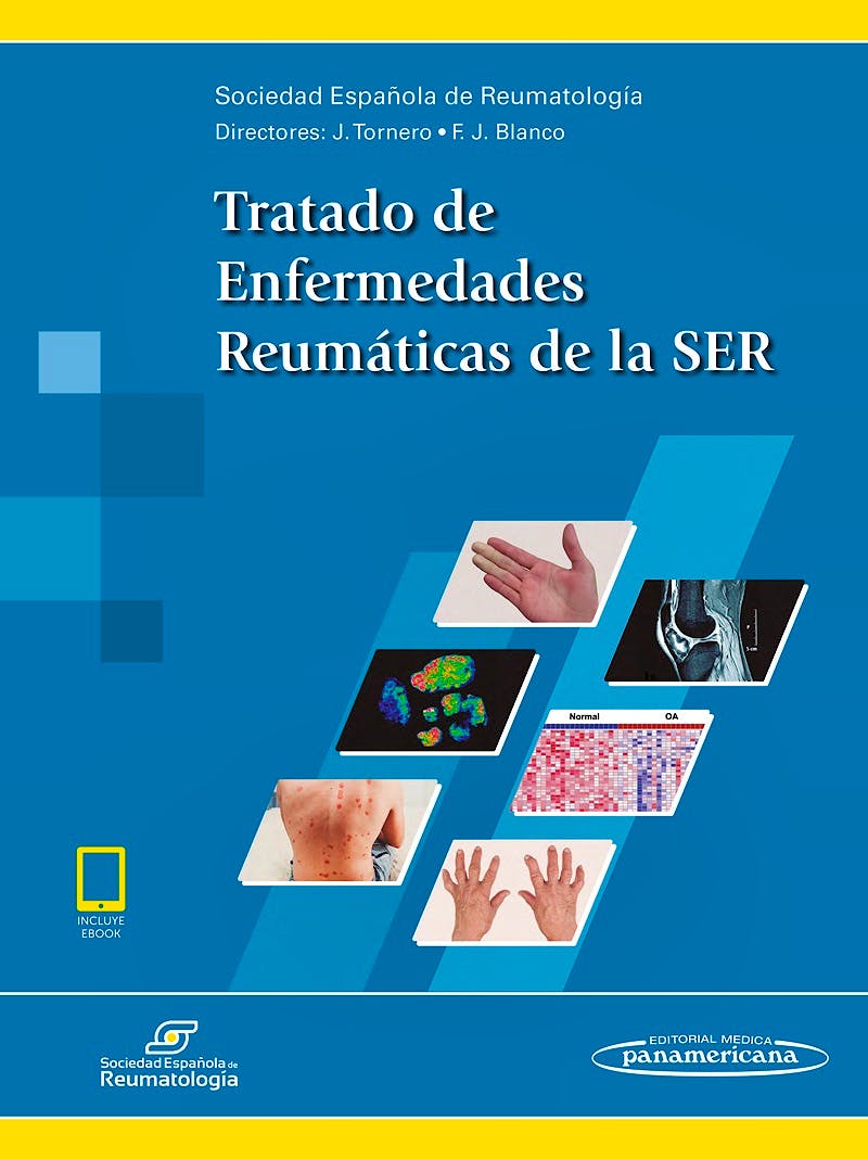 Portada del libro 9788491102816 Tratado de Enfermedades Reumáticas de la SER (Incluye E-Book)