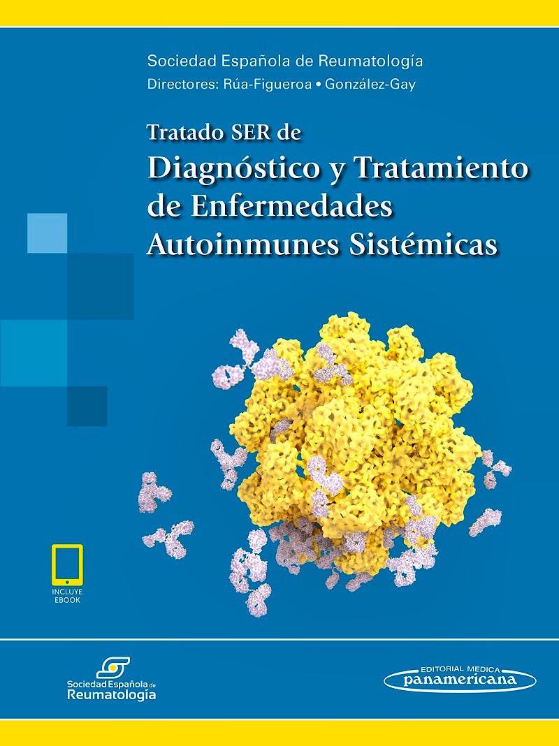 Tratado SER de Diagnóstico y Tratamiento de Enfermedades Autoinmunes Sistémicas