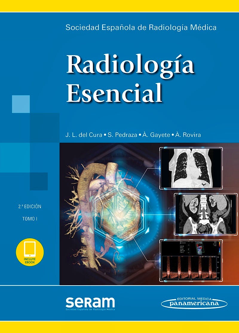 Portada del libro 9788491103493 SERAM Radiología Esencial, 2 Vols.