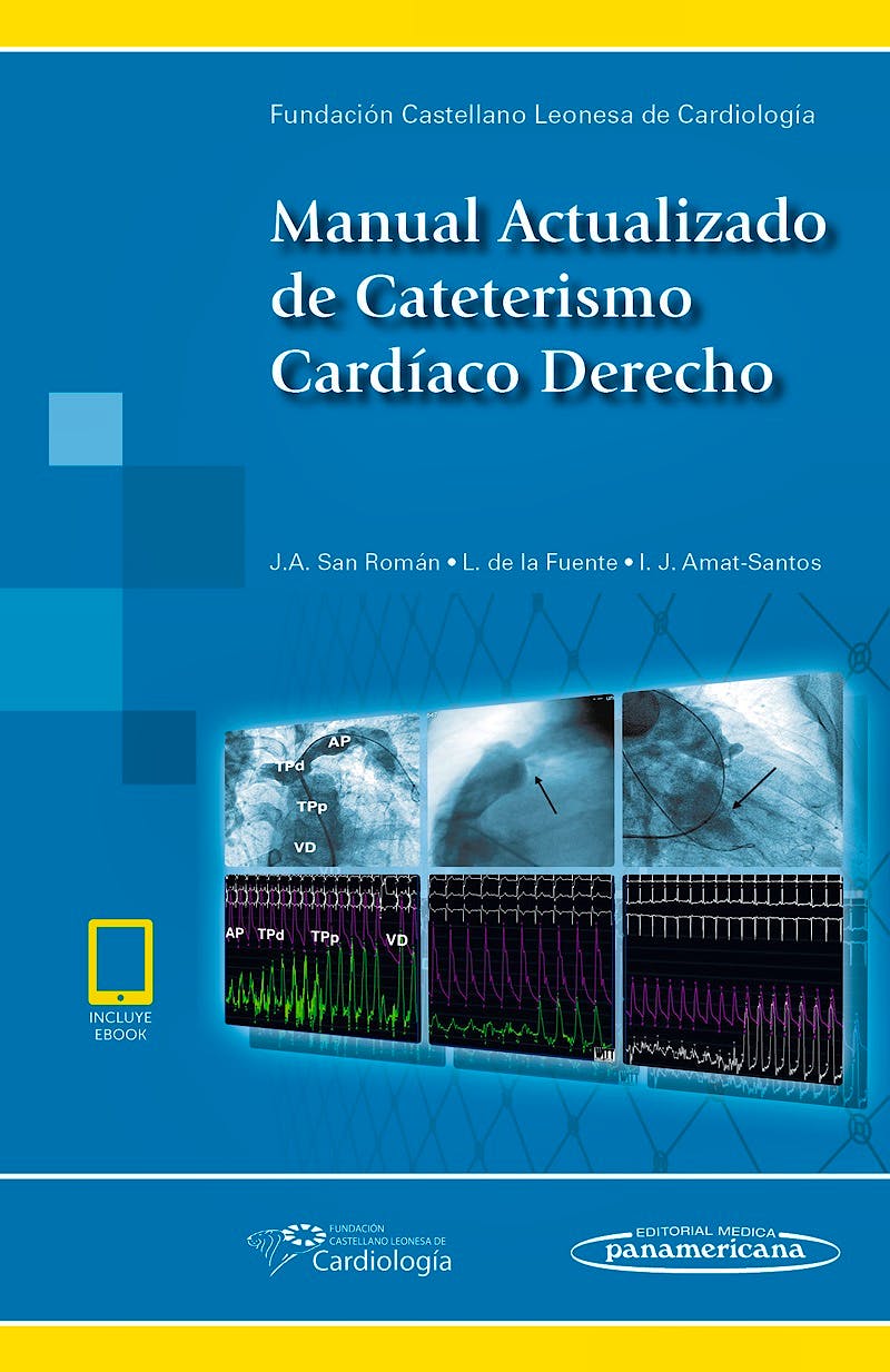 Portada del libro 9788491103769 Manual Actualizado de Cateterismo Cardíaco Derecho (incluye eBook)
