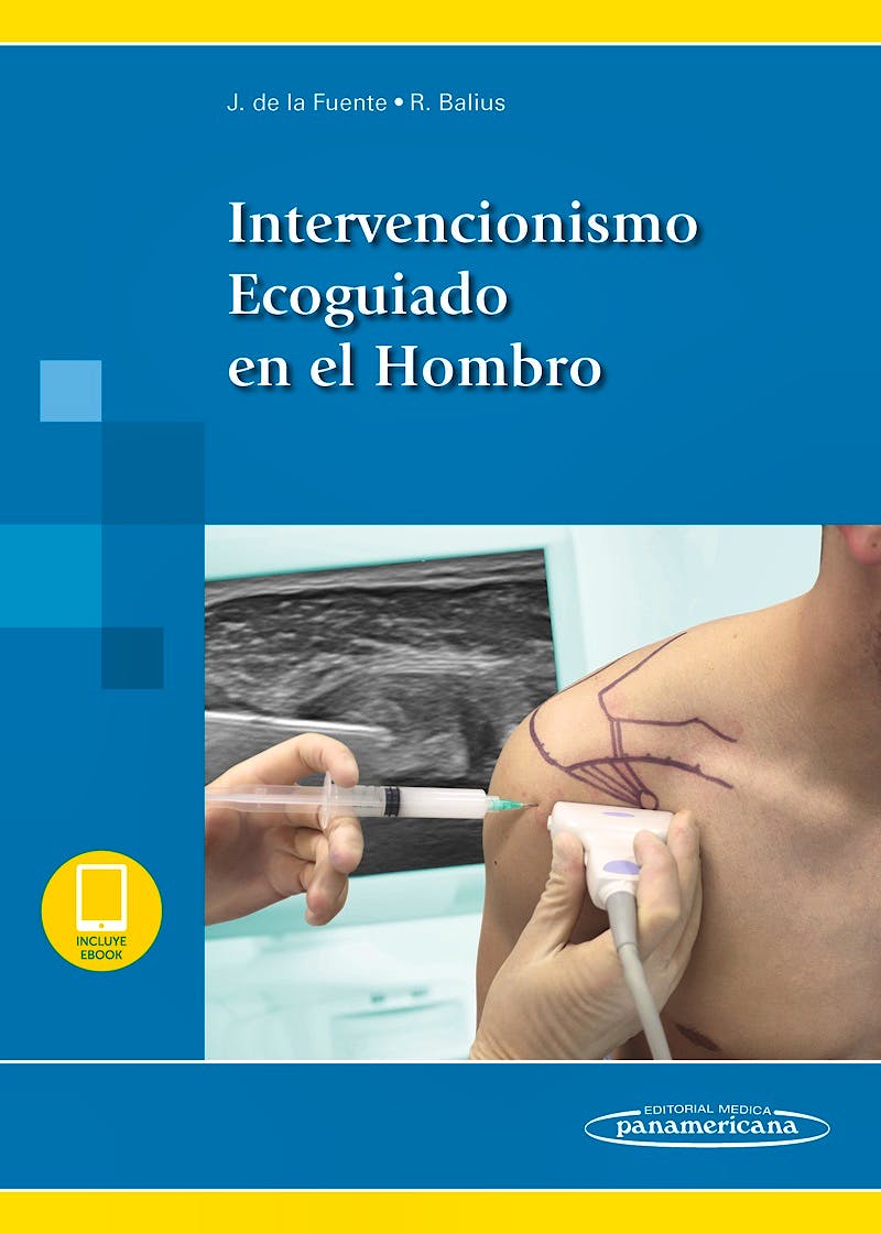 Portada del libro 9788491104704 Intervencionismo Ecoguiado en el Hombro (Incluye E-Book)