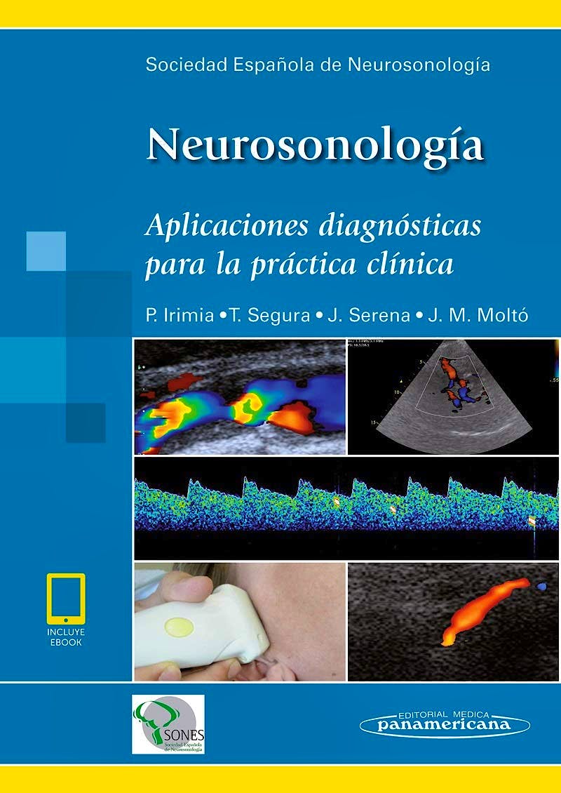 Portada del libro 9788491104766 Neurosonología. Aplicaciones Diagnósticas para la Práctica Clínica (Incluye eBook)