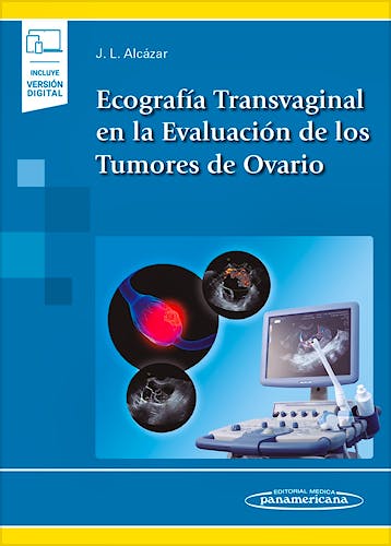 Portada del libro 9788491104971 Ecografía Transvaginal en la Evaluación de los Tumores de Ovario