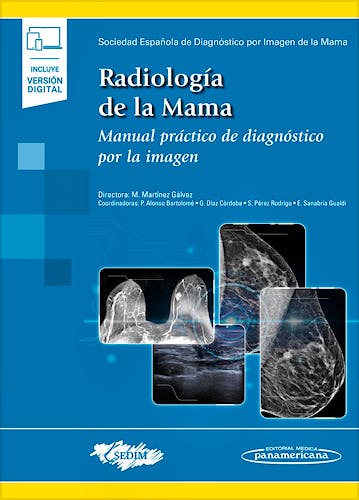 Portada del libro 9788491105534 Radiología de la Mama. Manual Práctico de Diagnóstico por la Imagen