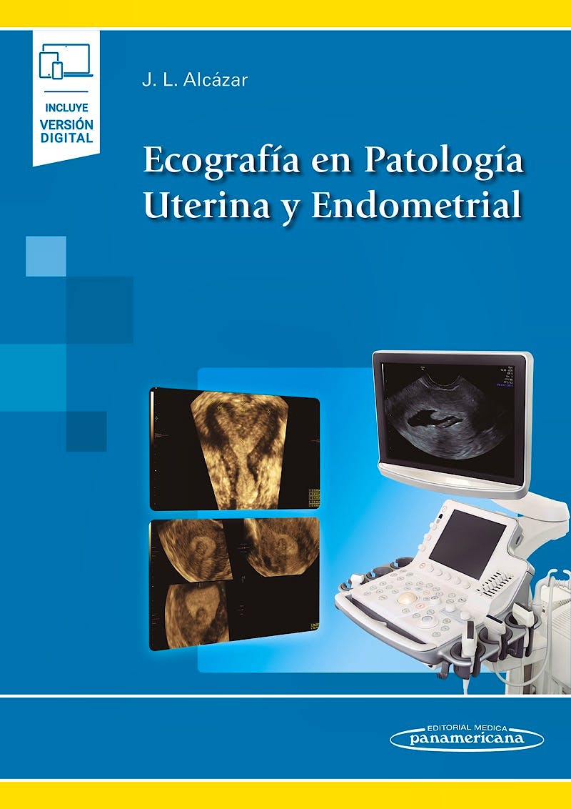 Portada del libro 9788491106135 Ecografía en Patología Uterina y Endometrial (Incluye Versión Digital)