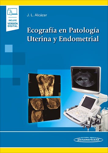 Portada del libro 9788491106135 Ecografía en Patología Uterina y Endometrial (Incluye Versión Digital)